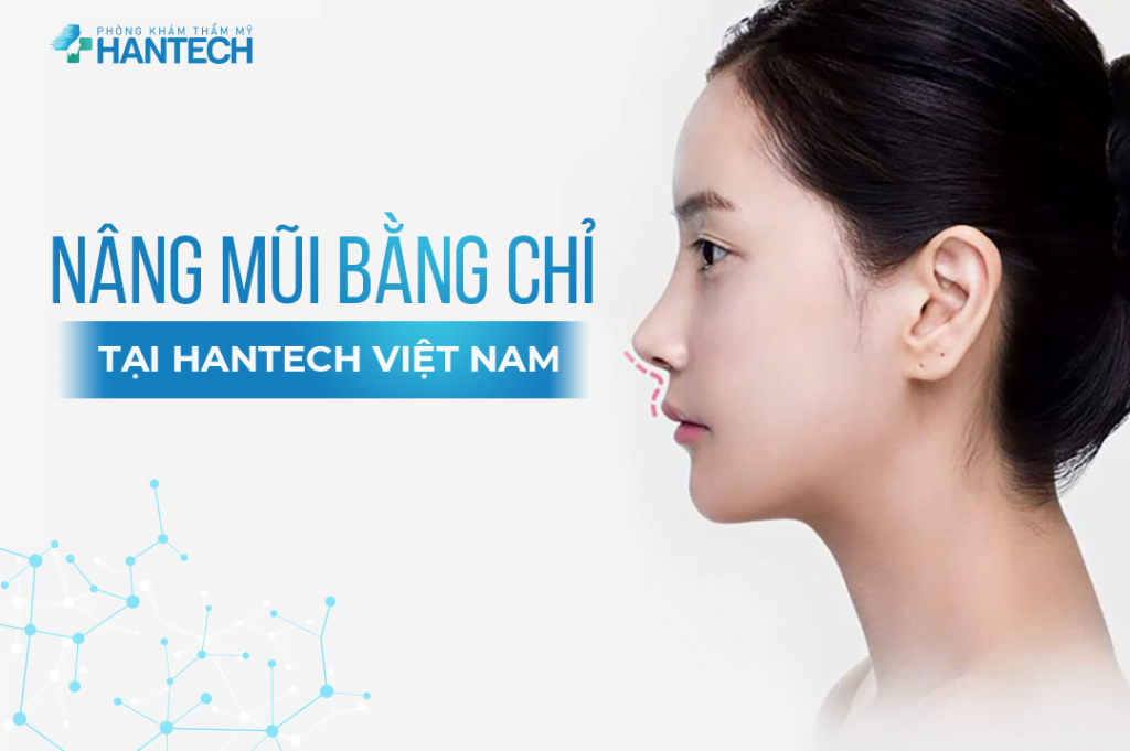 Nâng mũi bằng chỉ tại HanTech Việt Nam