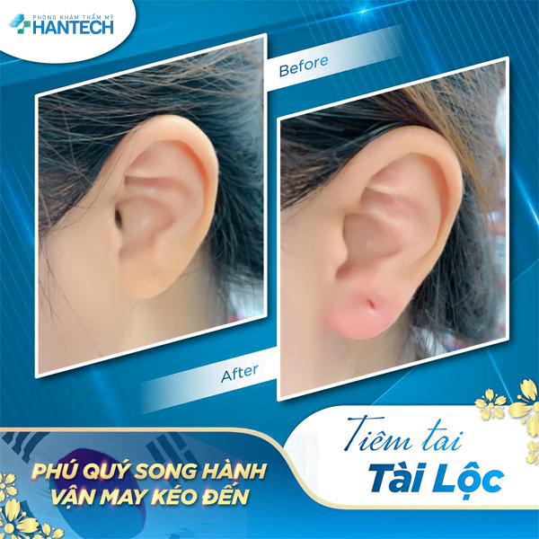 Tiêm tai tài lộc tại HanTech Việt Nam