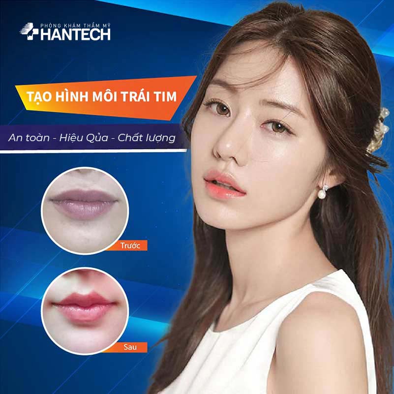 Tạo hình môi trái tim tại HanTech Việt Nam