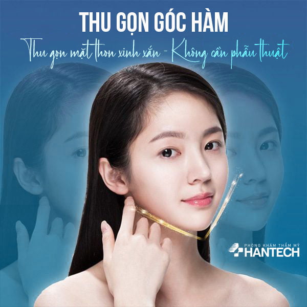 Thu gọn góc hàm - mặt thon xinh xắn - Không cần phẫu thuật