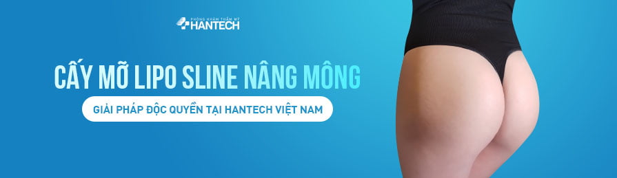 Cấy mỡ non Lipo Sline Nâng Mông