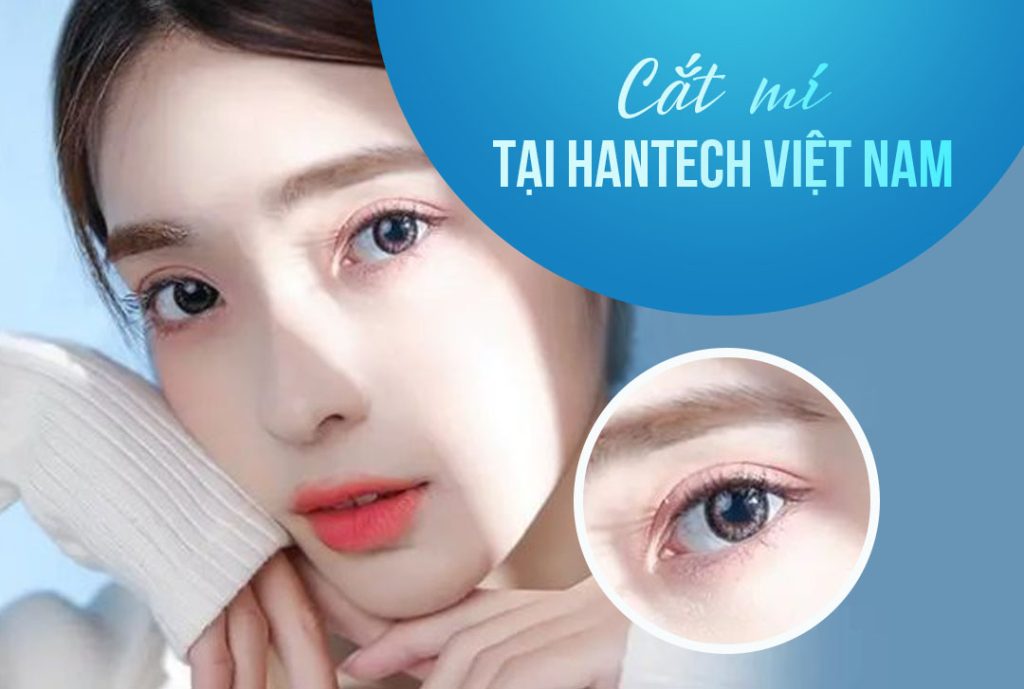 cắt mí tại HanTech Việt Nam