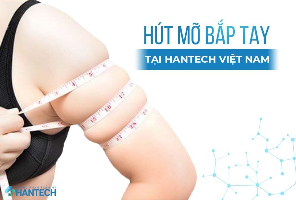 hút mỡ bắp tay tại hantech việt nam