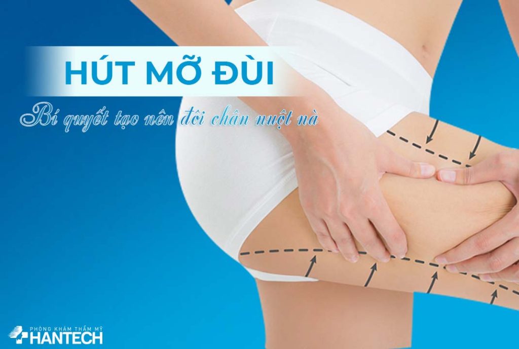 Hút mỡ đùi tại HanTech Việt Nam